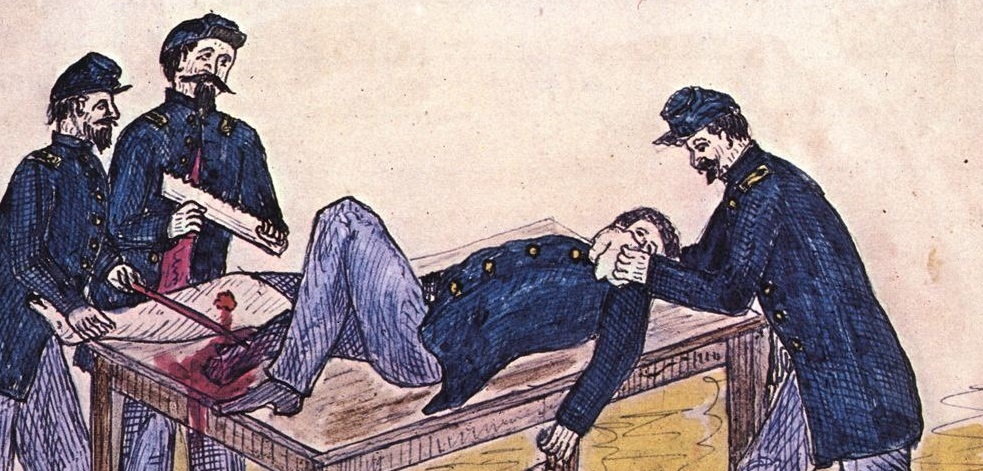 Bellard, Alfred, “Drawing of a Civil War Leg Amputation from the Diary of Alfred Bellard, 1860s,” Civil War In Minnesota Lives